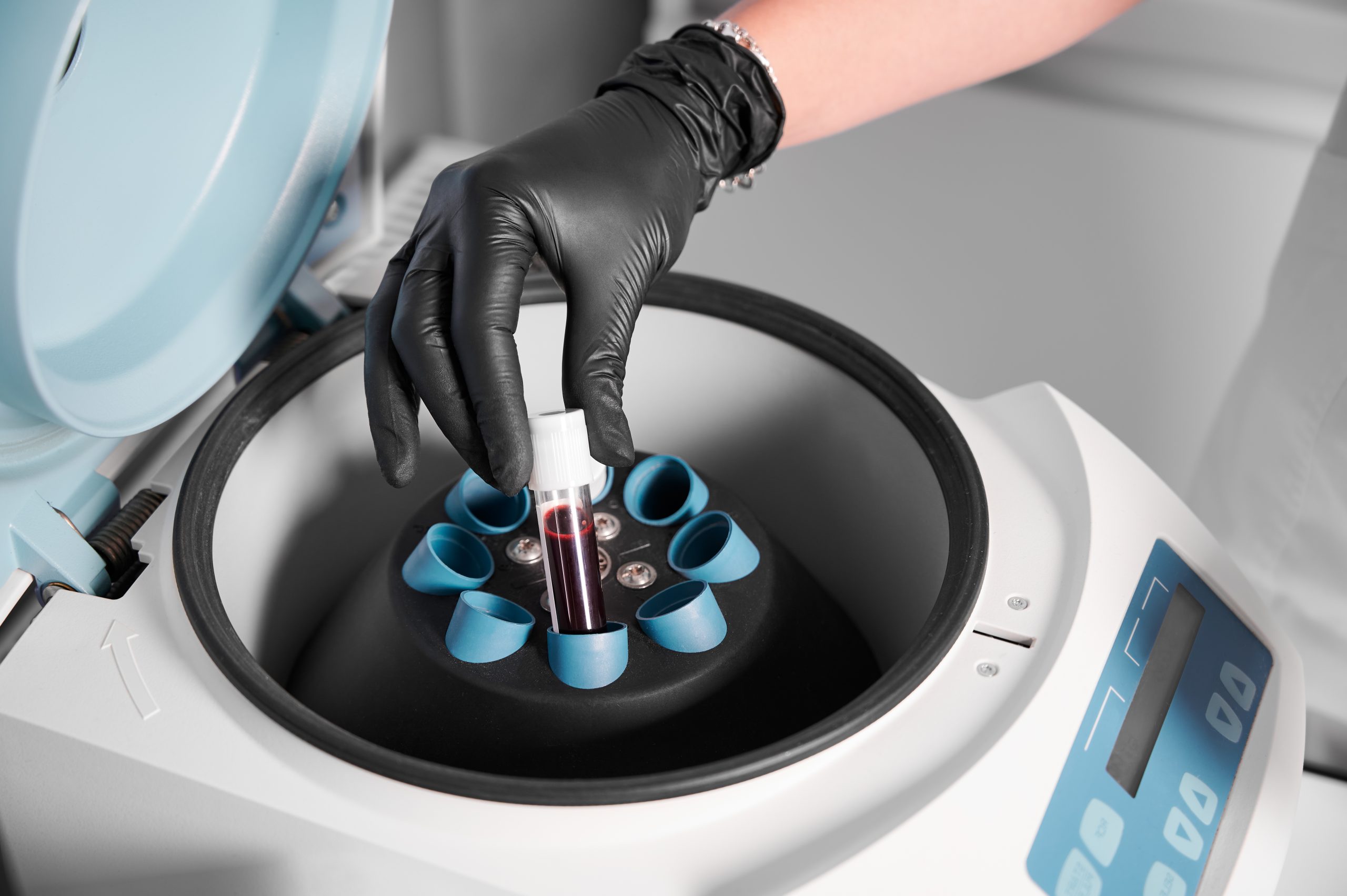 preparation of blood for injections. cosmetologist puts tube of blood in centrifuge